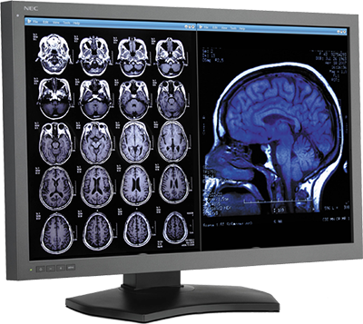Diagnostic workstation displaying brain MRI in iNtuition