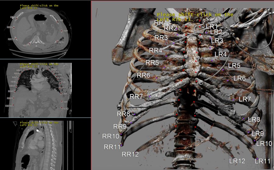 Rib labeling 3D view